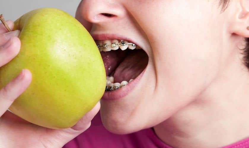 Braces in Roseville