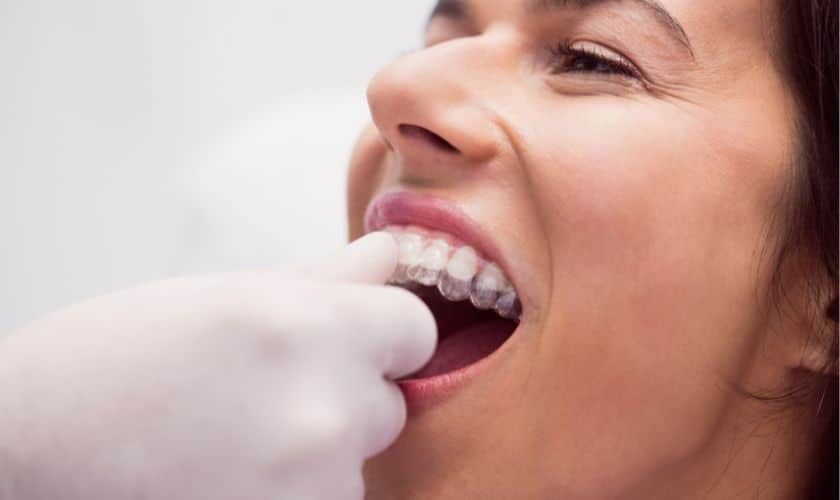 Invisalign in Roseville, CA- Dunn Orthodontics