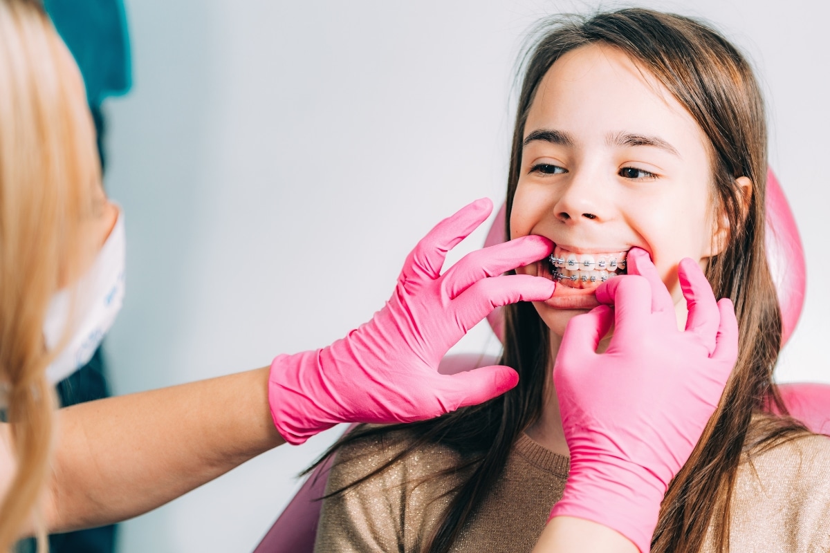 How Soon Do Braces Work? Discover the Braces Progress