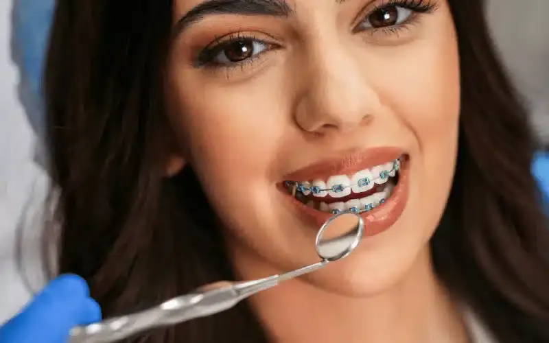 How to Care for Teeth and Braces During Treatment
