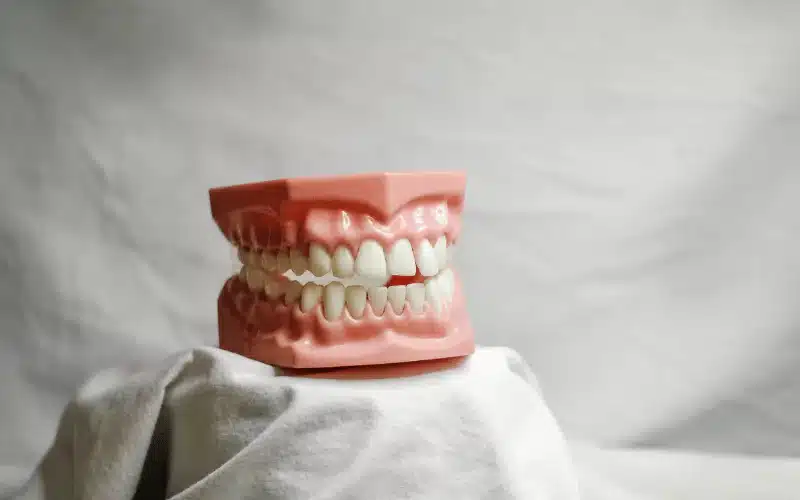 How Long Does It Take to Straighten Teeth: Braces vs. Clear Aligners