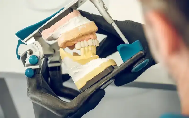 5 Reasons to Choose Orthodontists over Dentists
