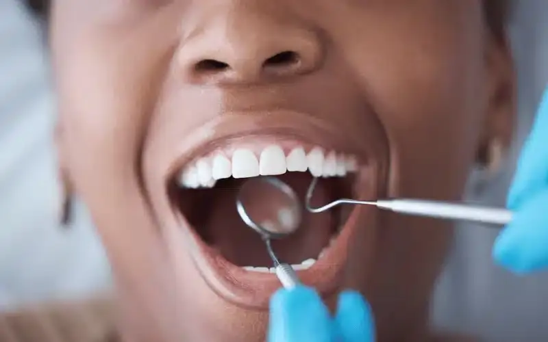 How to Maintain Oral Health During Orthodontic Treatment
