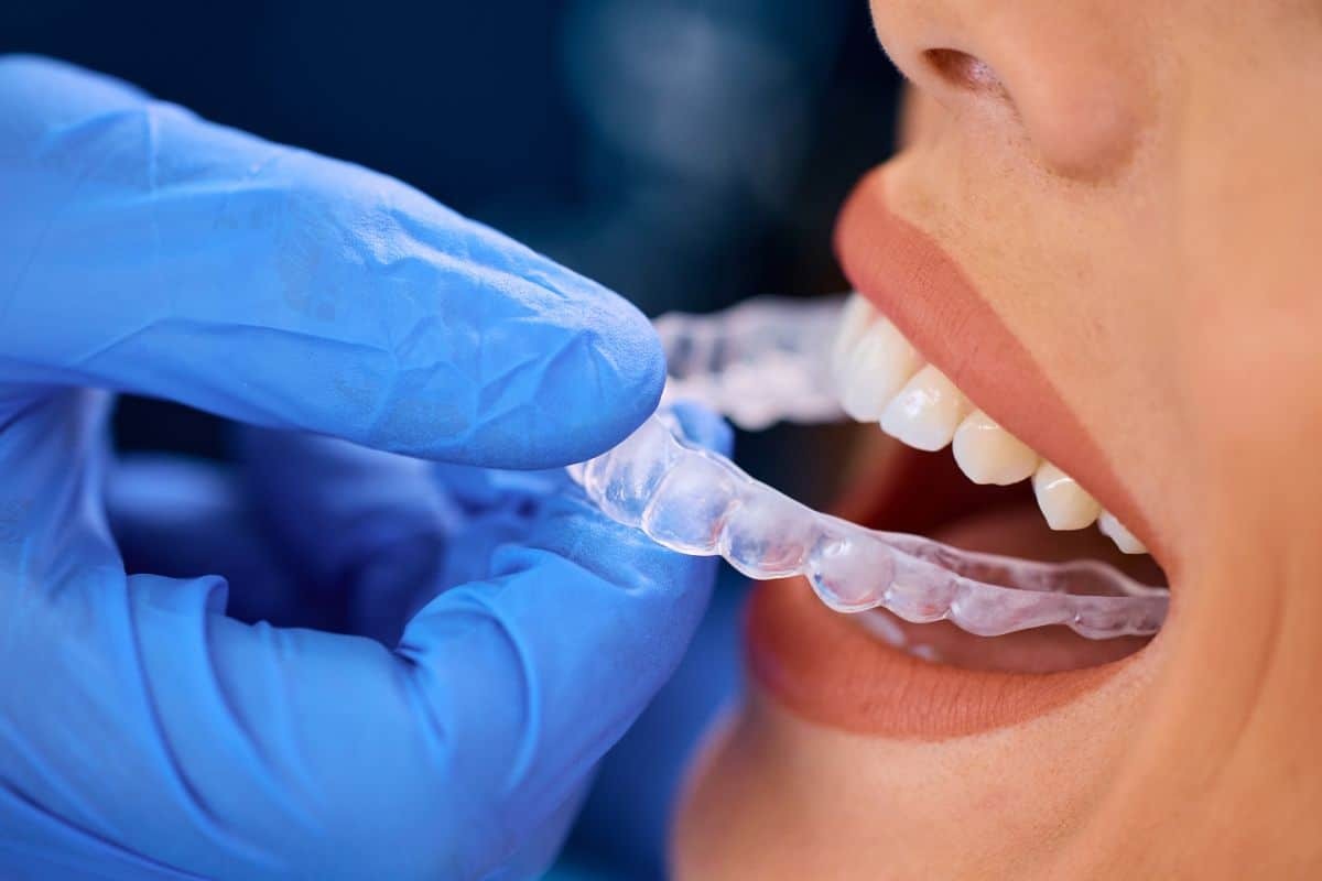 Orthodontist placing a clear Invisalign aligner onto a patient's teeth.