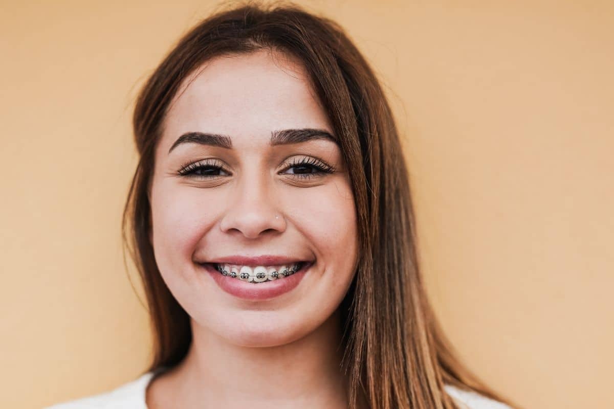 Smiling young woman with braces, representing successful orthodontic treatment for bite alignment issues.