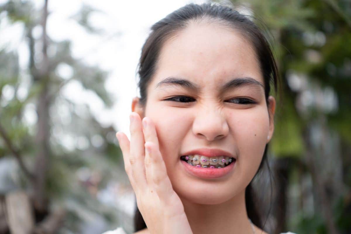 Patient wearing braces showing orthodontic treatment for anterior crossbite correction.