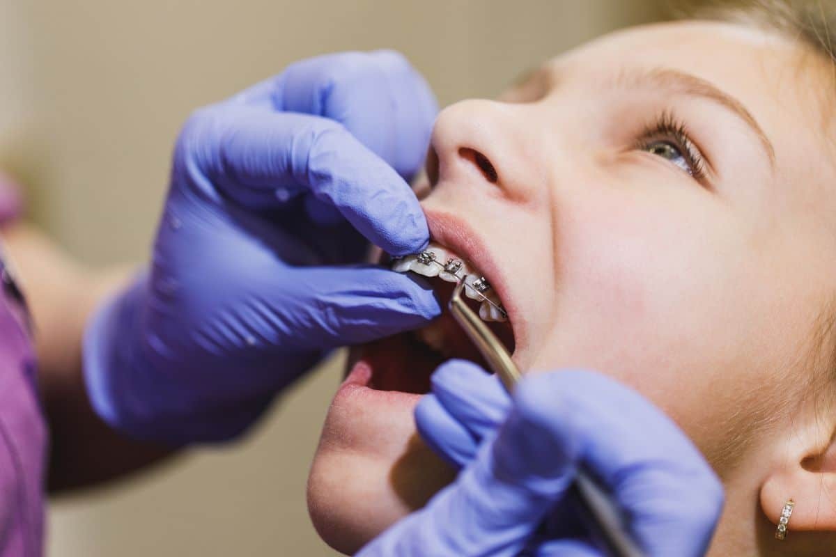 A child receiving early orthodontic evaluation for interceptive orthodontics.