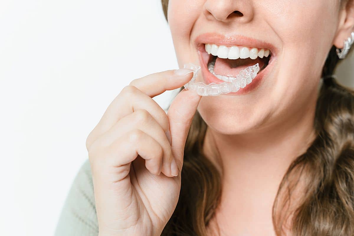 Person placing a clear Invisalign aligner, showing comfortable and discreet teeth-straightening treatment.