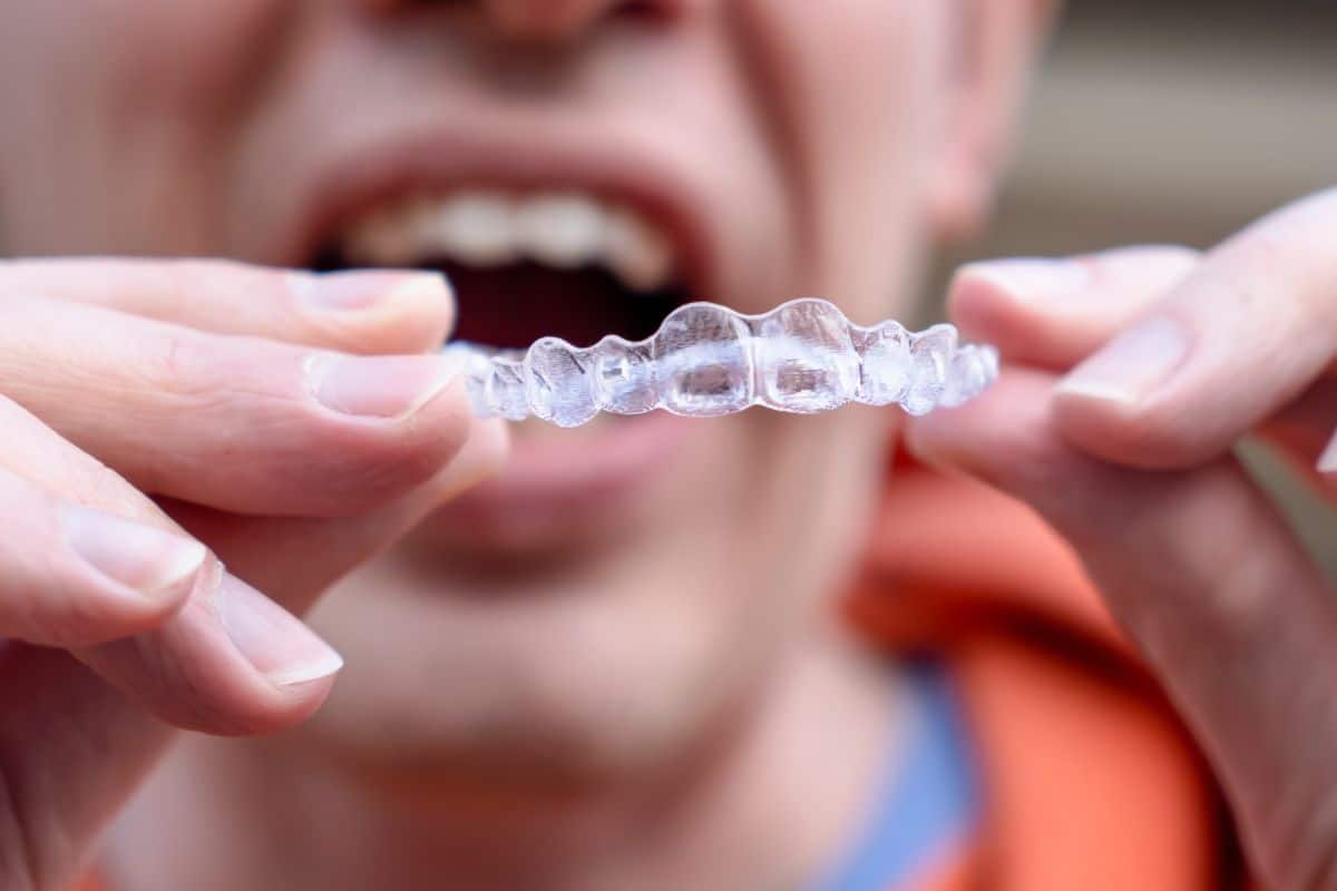 Close up of a patient holding clear Invisalign aligners before starting orthodontic treatment.